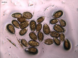 Ostreopsis ovata: l’alga invisibile che ...